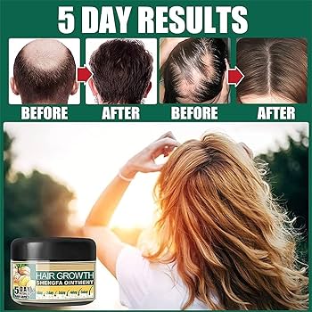 💇♀️VITAL ROOT💇CREMA DE JENGIBRE🫚PARA CRECER EL CABELLO X 30g📏 EELHOE🍃