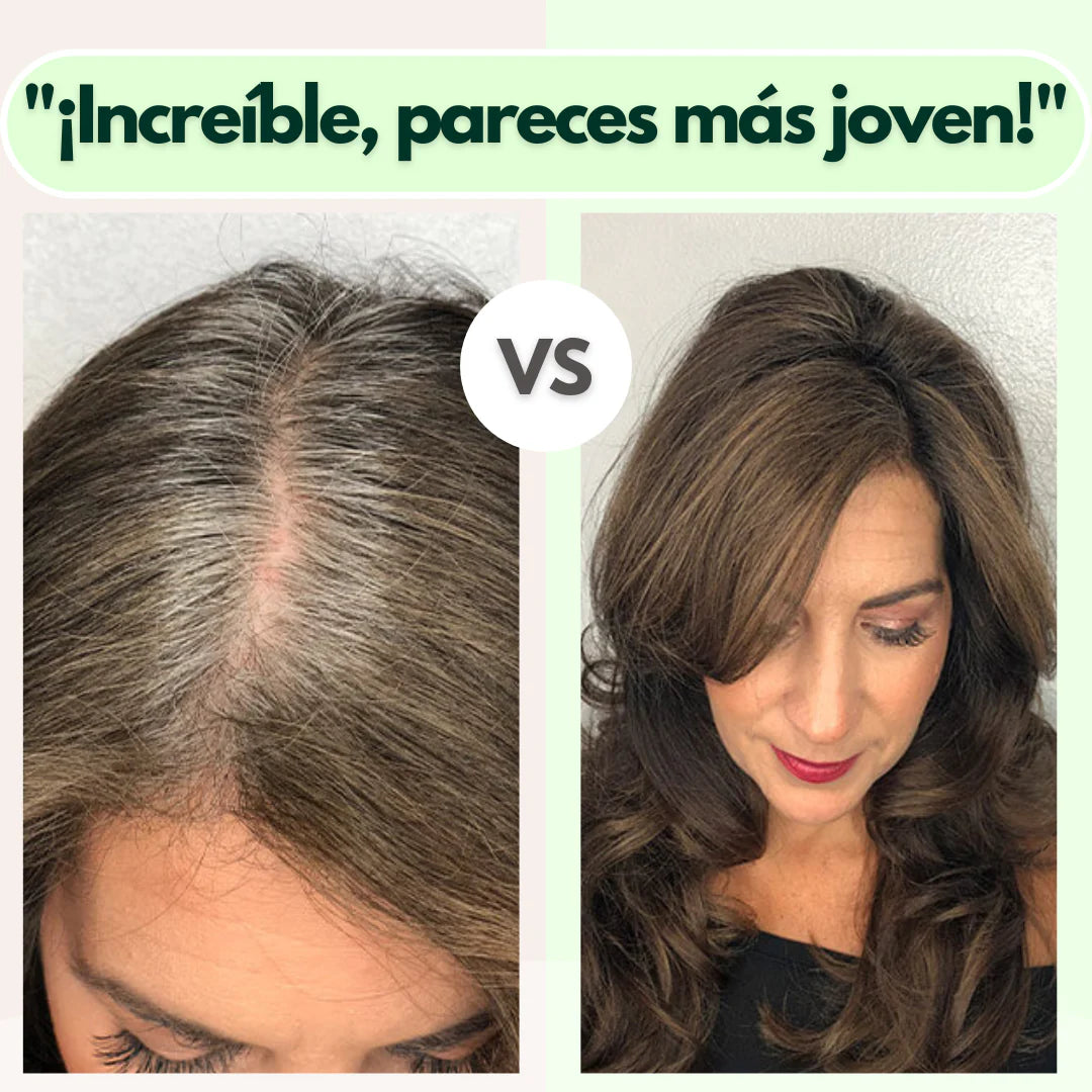 VITALOCKS🌿KIT CUBRE CANAS🎁 (SHAMPOO, COLAGENO+TÓNICO GRATIS ) ENVIÓ GRATIS🎁