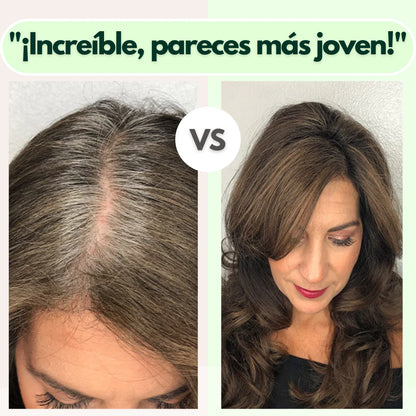 VITALOCKS🌿KIT CUBRE CANAS🎁 (SHAMPOO, COLAGENO+TÓNICO GRATIS ) ENVIÓ GRATIS🎁